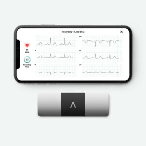 AliveCor_Kardia_Mobile_6L_06